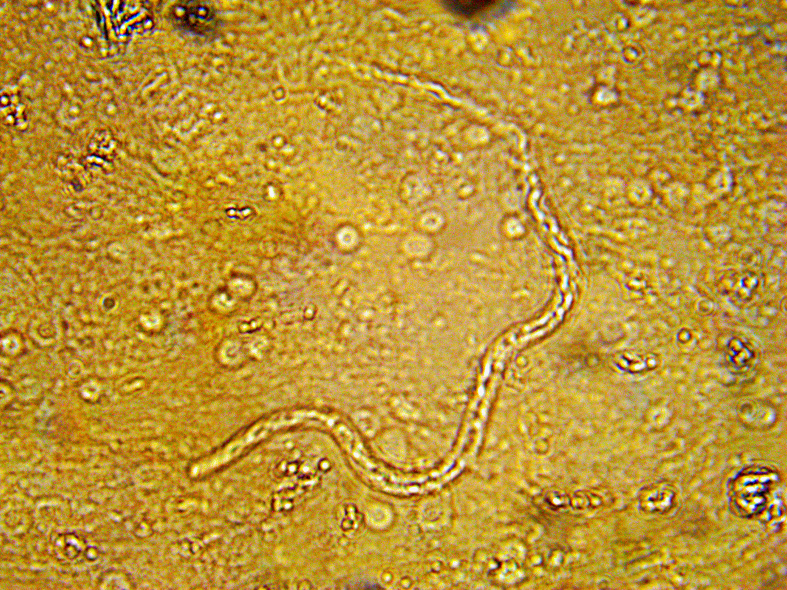 Микрофилярия среди разрушенных форменных элементов крови (фото О.В. Бяковой)